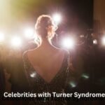 10 Female Celebrities with Turner Syndrome
