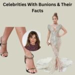 11 Celebrities With Bunions & Their Facts