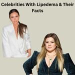 Top 10 Celebrities with Lipedema: Updated List of 2024