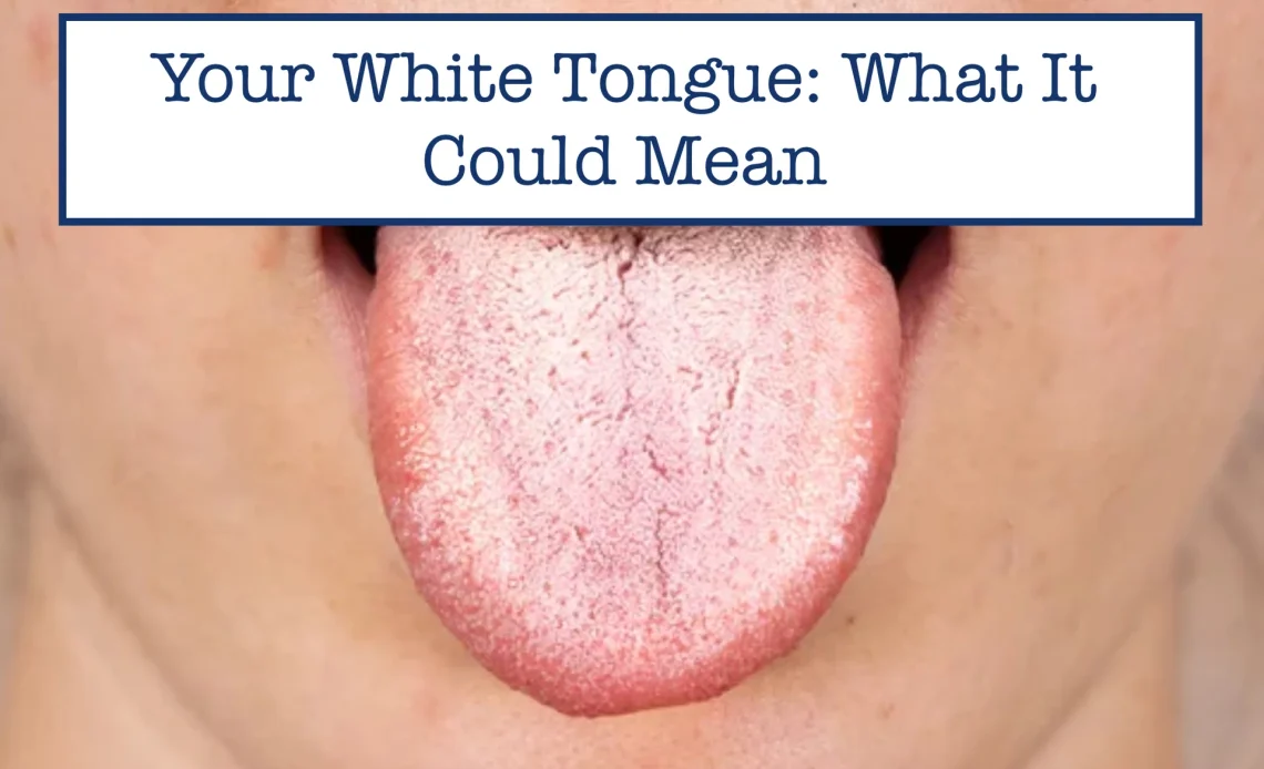 Why Is My Tongue White — Oral Health Warning Signs (2026)