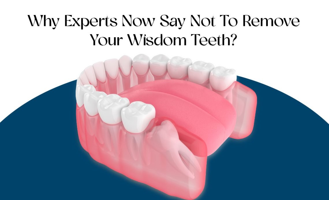 Why Experts Now Say Not to Remove Your Wisdom Teeth 2026