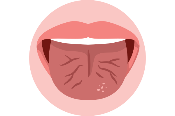 Why Does the Side of My Tongue Hurt? Causes & Quick Relief 2026