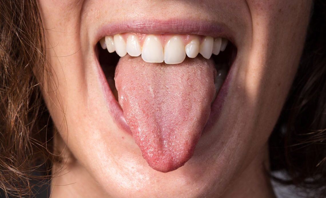 Why Does the Tip of My Tongue Hurt? Quick Relief Tips 2026