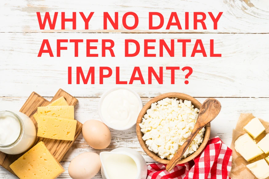 Why No Dairy After Dental Implant Surgery: Recovery Tips 2026