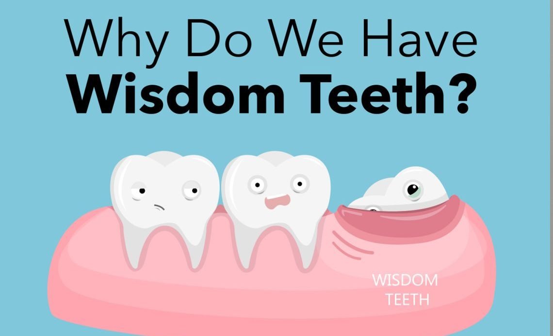 Why Are Wisdom Teeth Called Wisdom Teeth? The Real Reason 2026