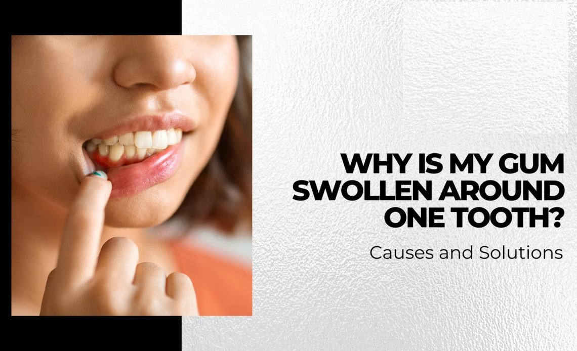 Why Is My Gum Swollen Around One Tooth — Dentist Advice 2026