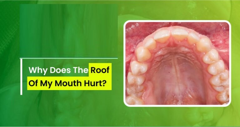 Why Does the Top of My Mouth Hurt? Causes & Relief 2026