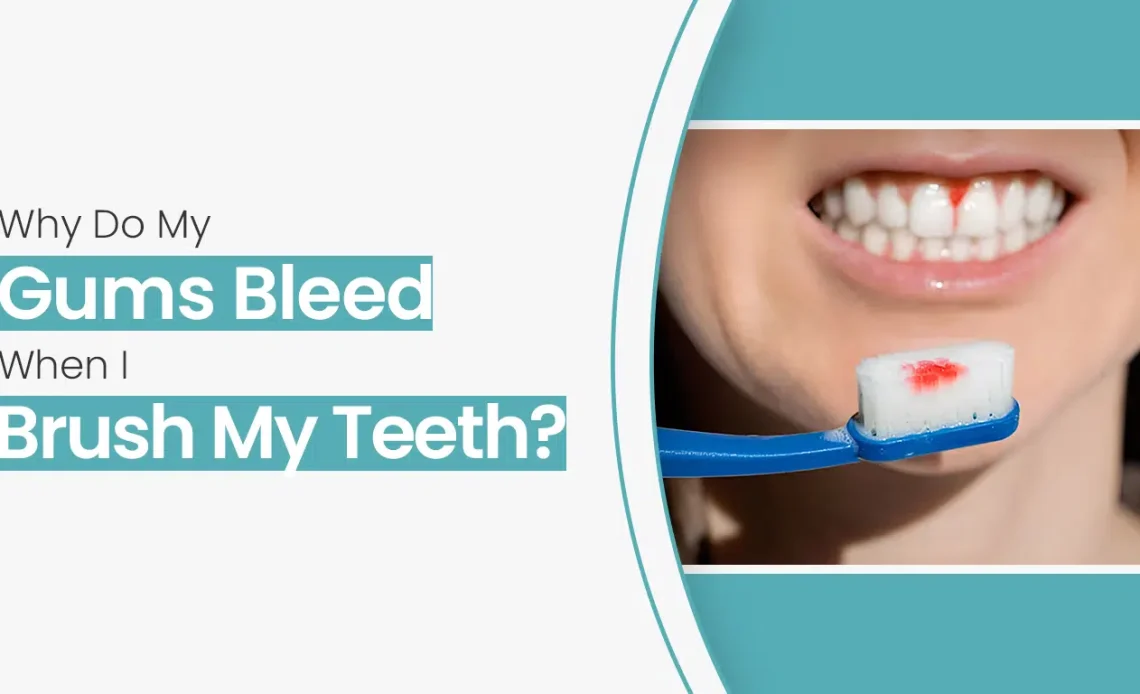 Why Do My Gums Bleed When I Brush My Teeth? Causes 2026