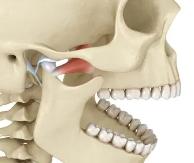 Why Does My Jaw Click When I Chew? Easy Relief Tips 2026