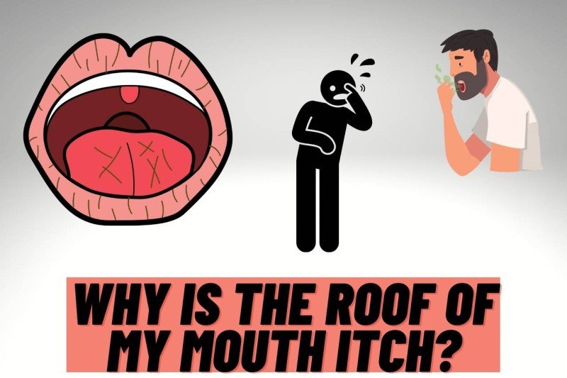 Why Is the Roof of My Mouth Itchy? Signs to Know 2026