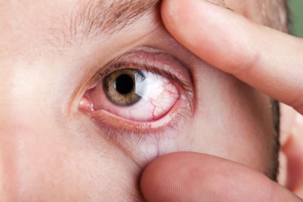 Why Does My Eyeball Hurt? Symptoms & Treatment 2026