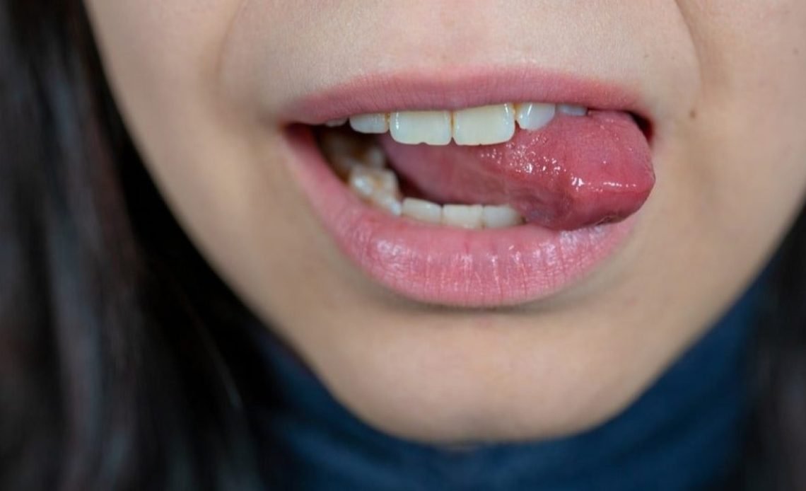 Why Do I Bite My Tongue When I Sleep? Night Causes 2026