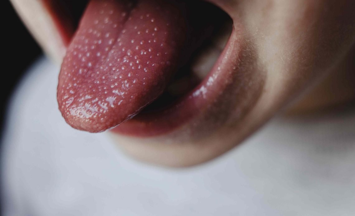 Why Do I Have Bumps on My Tongue? Common Causes 2026