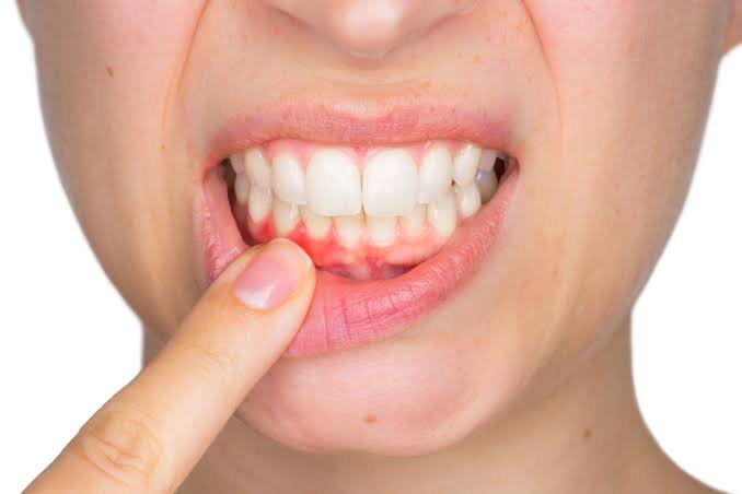 Why Do My Gums Suddenly Hurt? Dental Causes Explained 2026