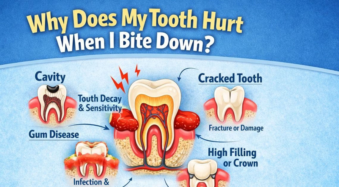 Why Does My Teeth Hurt When I Bite Down? Warning Signs 2026