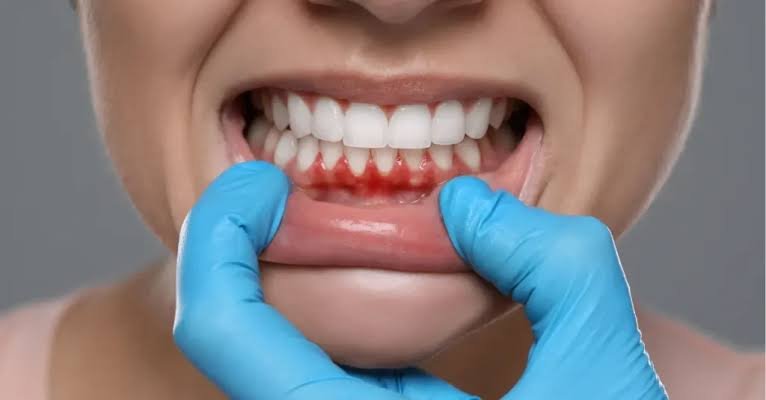 Why Does My Gum Hurt in One Spot? Common Causes 2026