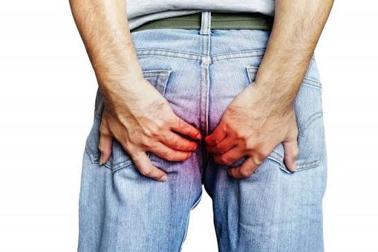 Why Does My Butthole Itch? Causes & Home Remedies 2026