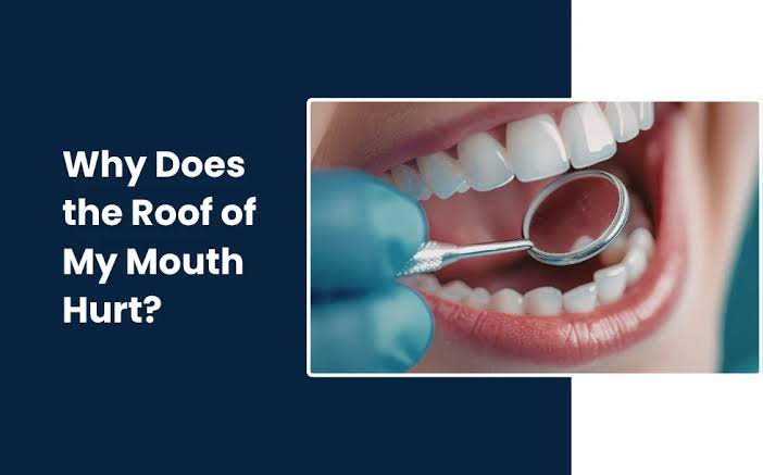 Why Is the Roof of My Mouth Sore? Causes & Treatment (2026 Guide)