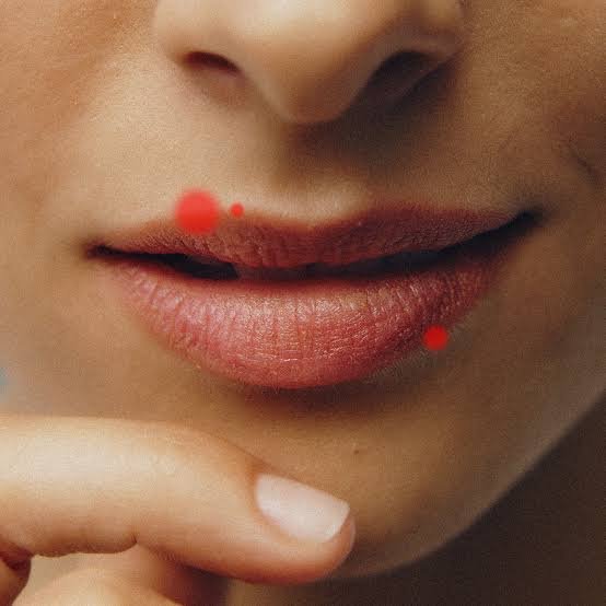 Why Do I Have a Bump on My Lip? Cold Sore or Cyst? 2026
