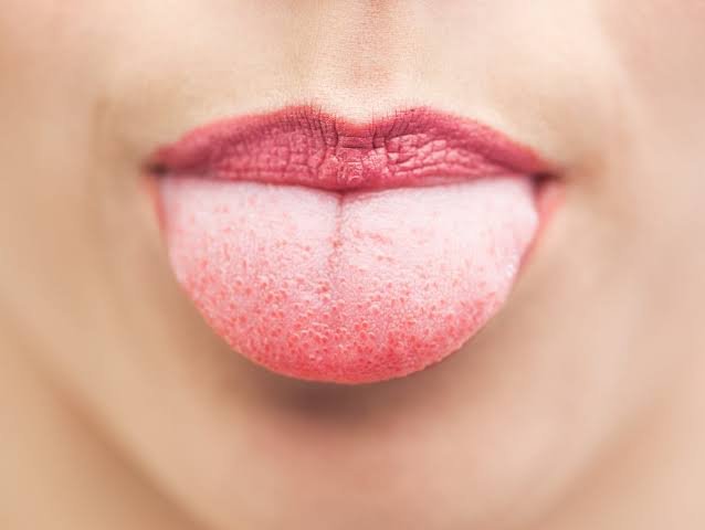 Why Are My Taste Buds Swollen? Causes & Treatment 2026