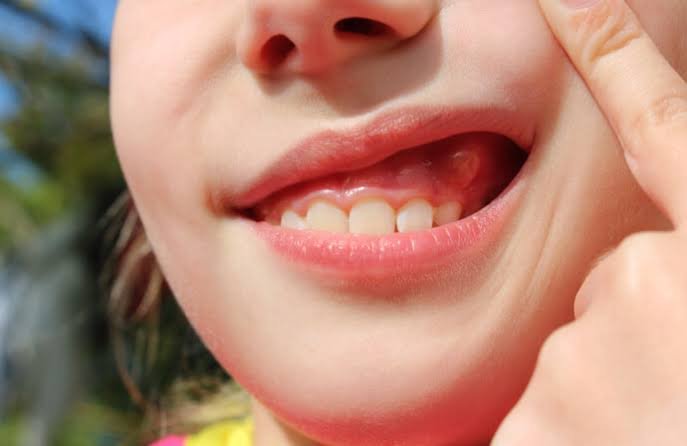 Why Does My Gum Hurt When I Touch It? Causes & Relief 2026