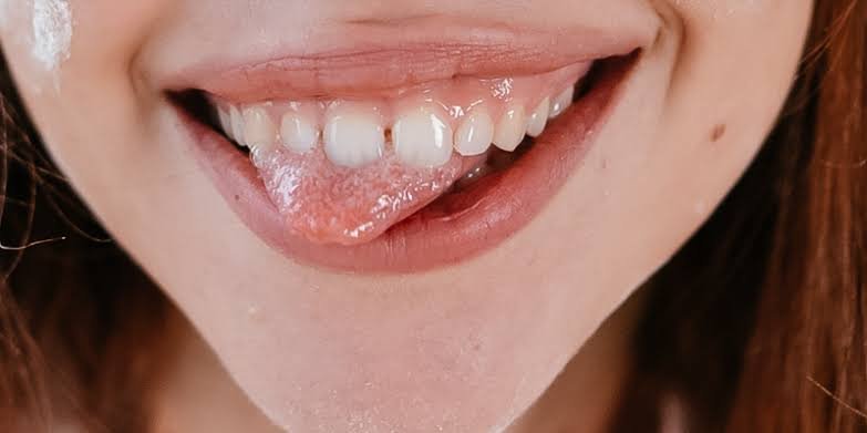 Why Are My Teeth Transparent? Prevention Tips 2026
