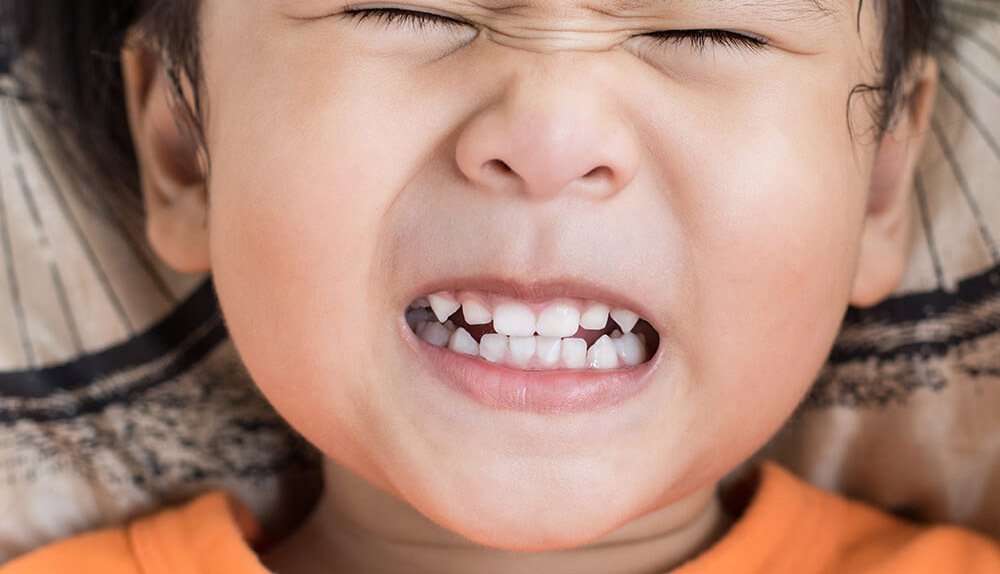 Why Do Kids Grind Their Teeth? Causes & What to Do 2026