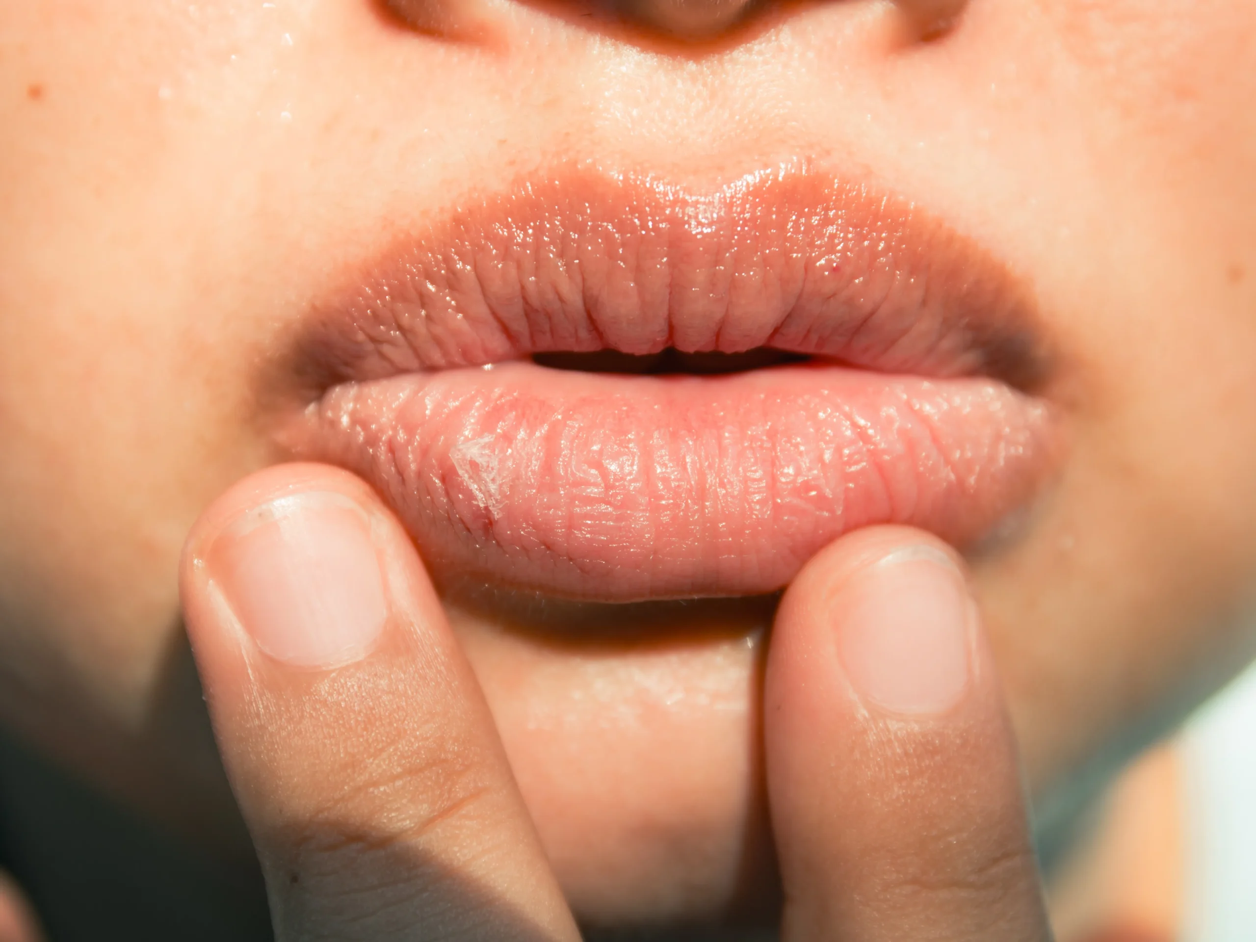Why Are My Lips Dry? Causes & Fast Relief (2026)
