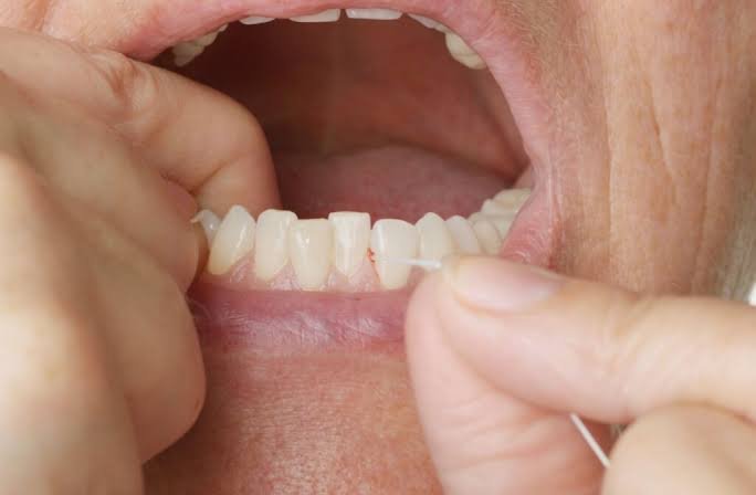 Why Do My Bottom Gums Hurt? Causes & Relief (2026) 