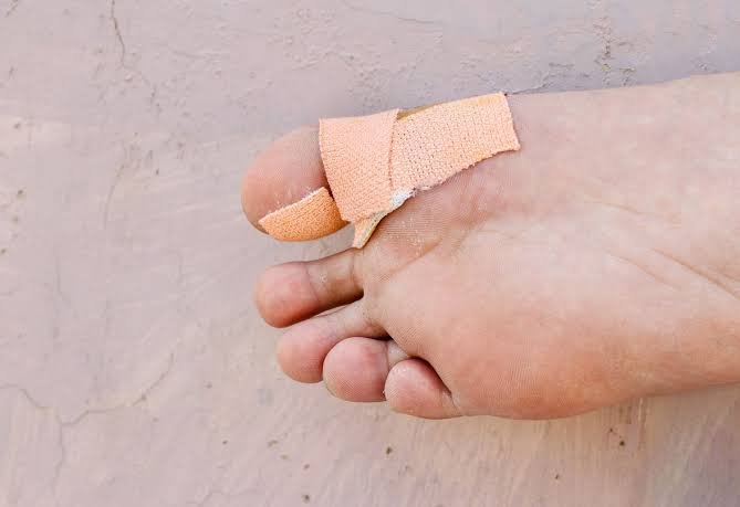 Why Is My Toe Swollen? Causes and When to See a Doctor 2026