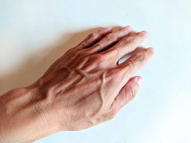 Why Do My Veins Pop Out on My Hands? Causes Explained 2026