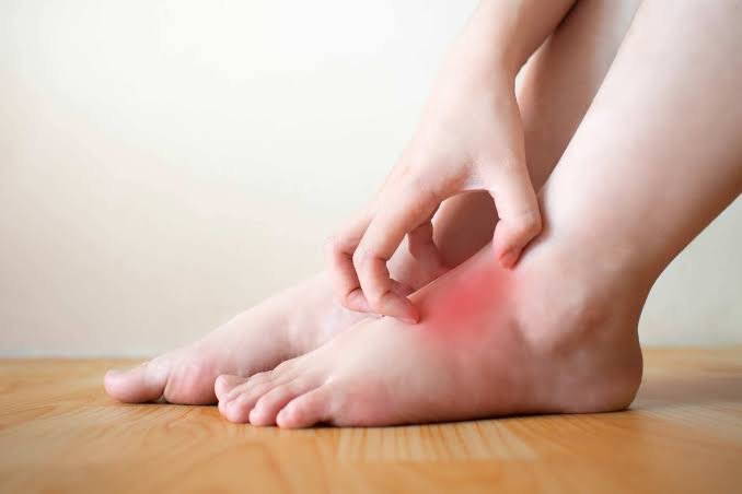 Why Does My Foot Itch? Common Causes & Relief 2026