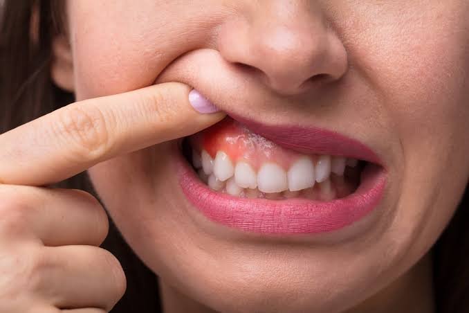 Why Is My Gum Swollen Around One Tooth No Pain? Causes 2026