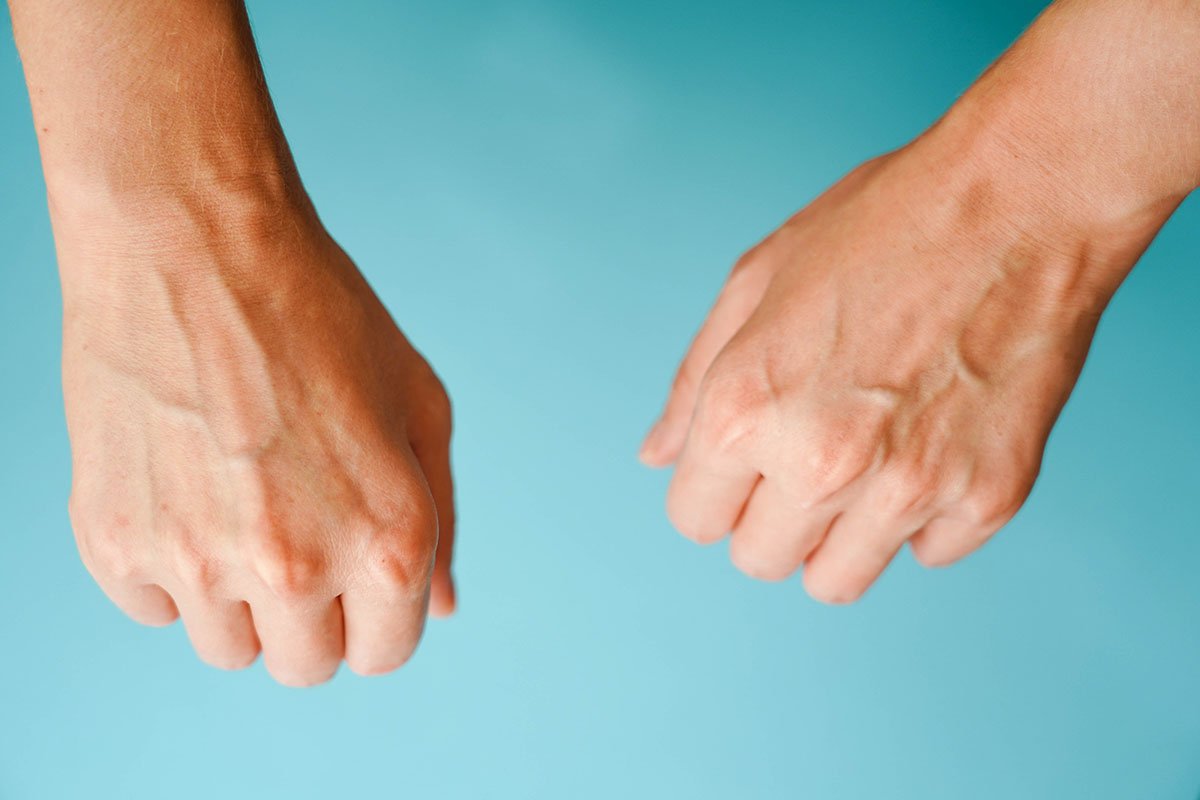 Why Do My Veins Pop Out on My Hands? Causes Explained 2026